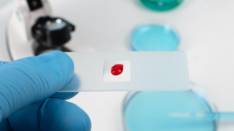 Hematología y hemoterapia
